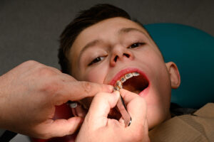 Young boy with braces receiving dental care from a pediatric dentist